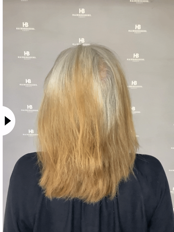 Jaqueline Boerback Before and After